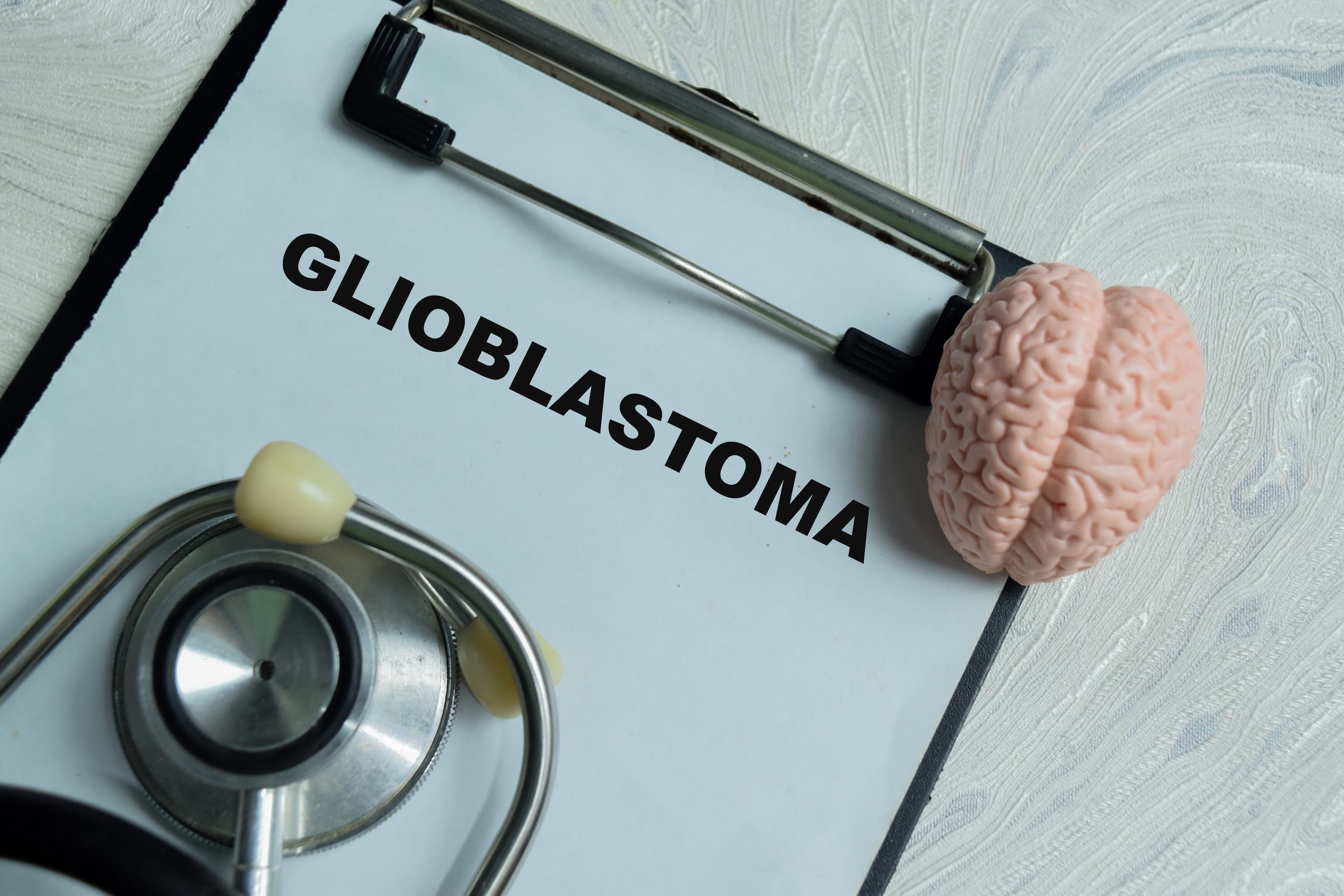 A clipboard labeled Glioblastoma beside a stethoscope and a model of a brain